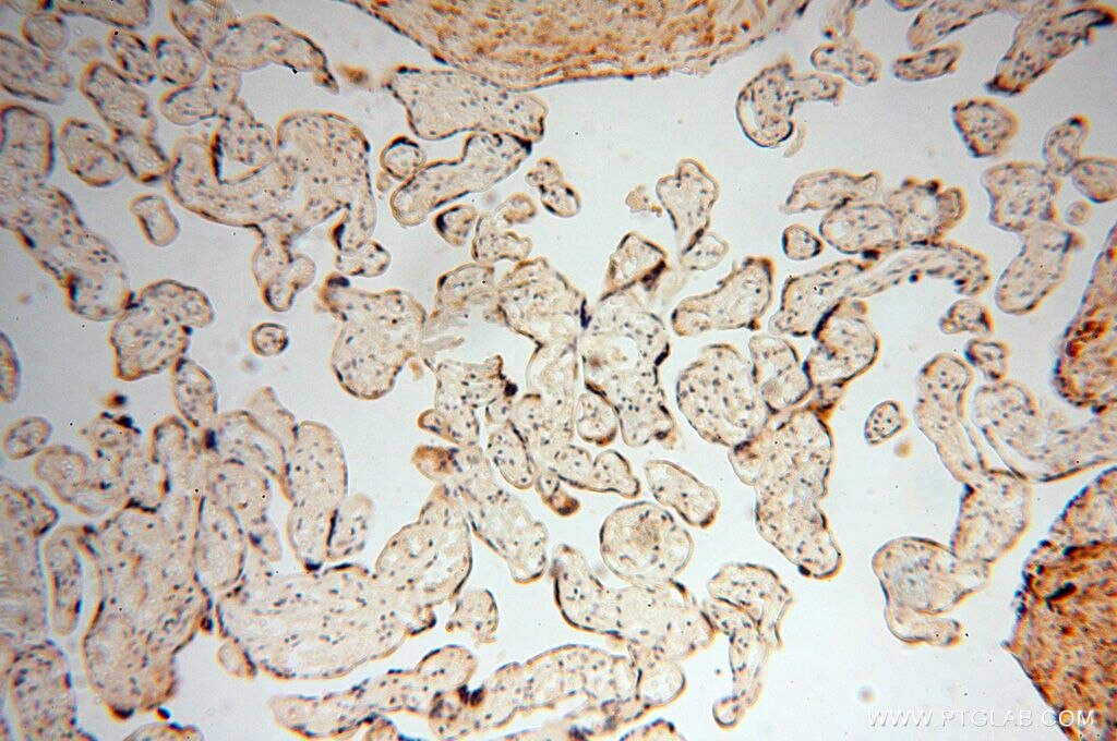 GALNTL2 IHC Immunohistochemical 16900-1-AP GALNTL2 Antibody DKFZp686H1113; GALNT13; GALNT15; GALNT7; PIH5