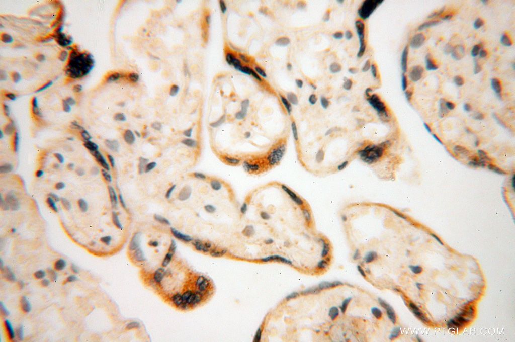 GALNTL2 IHC Immunohistochemical 16900-1-AP GALNTL2 Antibody DKFZp686H1113; GALNT13; GALNT15; GALNT7; PIH5