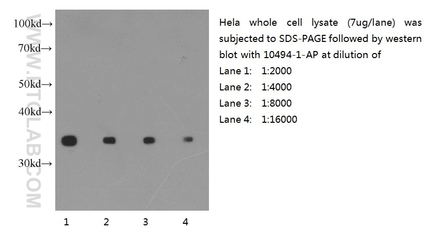 Western blot of Hela cell with anti-GAPDH (10494-1-AP) at various dilutions. GAPDH western blot WB 10494-1-AP GAPDH Antibody G3PD; GAPD; MGC88685