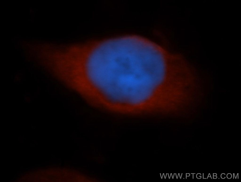 Immunofluorescent analysis of Hela cells, using GAPDH antibody 10494-1-AP at 1:50 dilution and Rhodamine-labeled goat anti-rabbit IgG (red). Blue pseudocolor = DAPI (fluorescent DNA dye). GAPDH Immunofluorescence IF 10494-1-AP GAPDH Antibody G3PD; GAPD; MGC88685