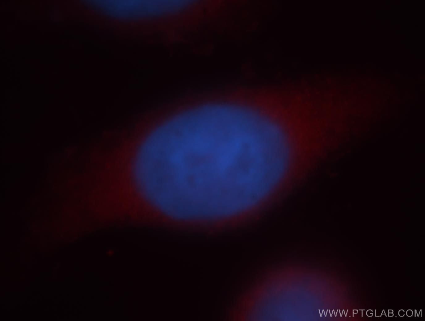 Immunofluorescent analysis of Hela cells, using GAPDH antibody 10494-1-AP at 1:25 dilution and Rhodamine-labeled goat anti-rabbit IgG (red). Blue pseudocolor = DAPI (fluorescent DNA dye). GAPDH Immunofluorescence IF 10494-1-AP GAPDH Antibody G3PD; GAPD; MGC88685