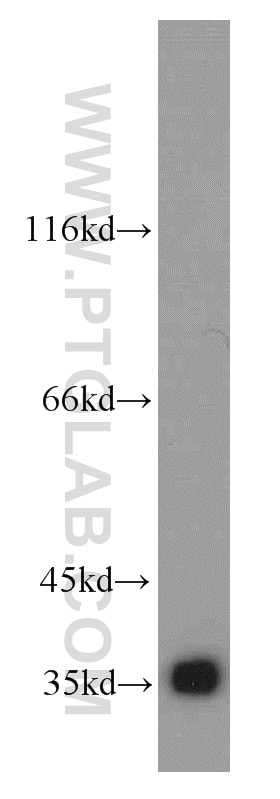 HEK-293 cells were subjected to SDS PAGE followed by western blot with GAPDH Antibody 10494-1-AP GAPDH western blot WB 10494-1-AP GAPDH Antibody G3PD; GAPD; MGC88685