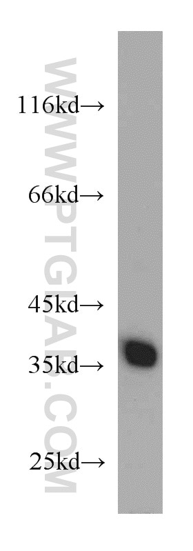 HeLa cells were subjected to SDS PAGE followed by western blot with GAPDH Antibody 10494-1-AP GAPDH western blot WB 10494-1-AP GAPDH Antibody G3PD; GAPD; MGC88685