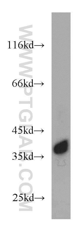 Jurkat cells were subjected to SDS PAGE followed by western blot with GAPDH Antibody 10494-1-AP GAPDH western blot WB 10494-1-AP GAPDH Antibody G3PD; GAPD; MGC88685