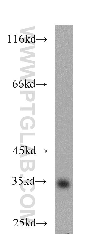 mouse lung tissue were subjected to SDS PAGE followed by western blot with GAPDH Antibody 10494-1-AP GAPDH western blot WB 10494-1-AP GAPDH Antibody G3PD; GAPD; MGC88685