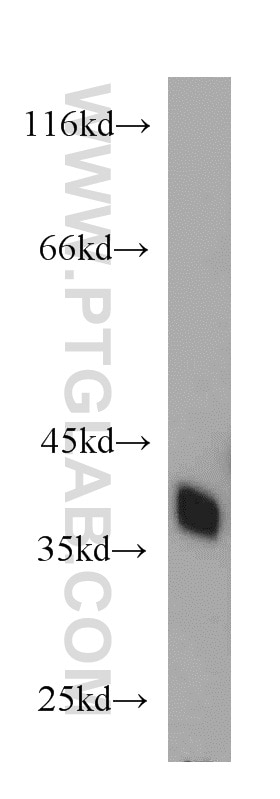 HEK-293 cells were subjected to SDS PAGE followed by western blot with GAPDH Antibody 10494-1-AP GAPDH western blot WB 10494-1-AP GAPDH Antibody G3PD; GAPD; MGC88685