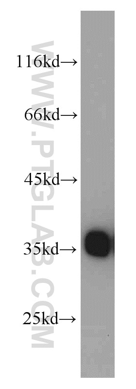 HeLa cells were subjected to SDS PAGE followed by western blot with GAPDH Antibody 10494-1-AP GAPDH western blot WB 10494-1-AP GAPDH Antibody G3PD; GAPD; MGC88685