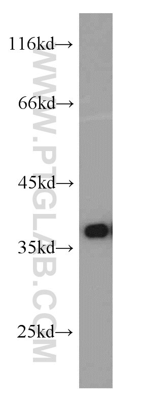 HeLa cells were subjected to SDS PAGE followed by western blot with GAPDH Antibody 10494-1-AP GAPDH western blot WB 10494-1-AP GAPDH Antibody G3PD; GAPD; MGC88685