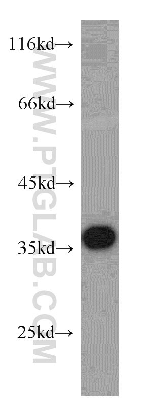 HeLa cells were subjected to SDS PAGE followed by western blot with GAPDH Antibody 10494-1-AP GAPDH western blot WB 10494-1-AP GAPDH Antibody G3PD; GAPD; MGC88685