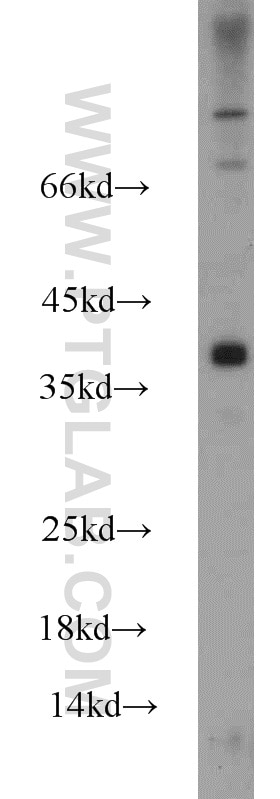 PC-13 cells were subjected to SDS PAGE followed by western blot with GAPDH Antibody 10494-1-AP GAPDH western blot WB 10494-1-AP GAPDH Antibody G3PD; GAPD; MGC88685