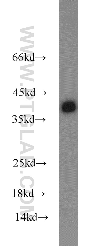 PC-13 cells were subjected to SDS PAGE followed by western blot with GAPDH Antibody 10494-1-AP GAPDH western blot WB 10494-1-AP GAPDH Antibody G3PD; GAPD; MGC88685