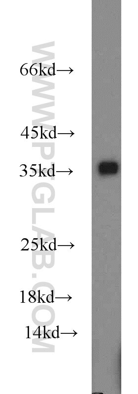 HeLa cells were subjected to SDS PAGE followed by western blot with GAPDH Antibody 10494-1-AP GAPDH western blot WB 10494-1-AP GAPDH Antibody G3PD; GAPD; MGC88685