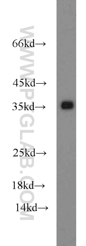 A549 cells were subjected to SDS PAGE followed by western blot with GAPDH Antibody 10494-1-AP GAPDH western blot WB 10494-1-AP GAPDH Antibody G3PD; GAPD; MGC88685