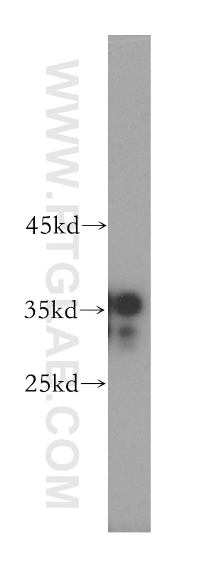 HeLa cells were subjected to SDS PAGE followed by western blot with GAPDH Antibody 10494-1-AP GAPDH western blot WB 10494-1-AP GAPDH Antibody G3PD; GAPD; MGC88685