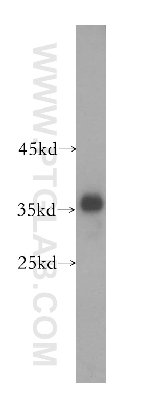 HEK-293 cells were subjected to SDS PAGE followed by western blot with GAPDH Antibody 10494-1-AP GAPDH western blot WB 10494-1-AP GAPDH Antibody G3PD; GAPD; MGC88685