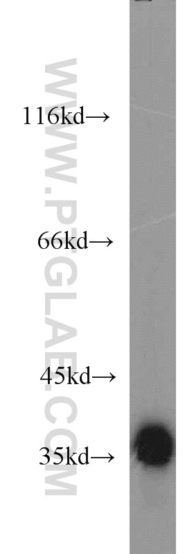 K-562 cells were subjected to SDS PAGE followed by western blot with GAPDH Antibody 10494-1-AP GAPDH western blot WB 10494-1-AP GAPDH Antibody G3PD; GAPD; MGC88685