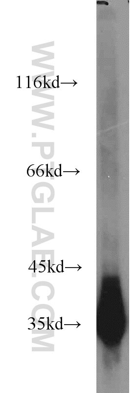 human testis tissue were subjected to SDS PAGE followed by western blot with GAPDH Antibody 10494-1-AP GAPDH western blot WB 10494-1-AP GAPDH Antibody G3PD; GAPD; MGC88685