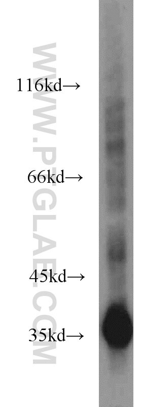 MDA-MB-453s cells were subjected to SDS PAGE followed by western blot with GAPDH Antibody 10494-1-AP GAPDH western blot WB 10494-1-AP GAPDH Antibody G3PD; GAPD; MGC88685