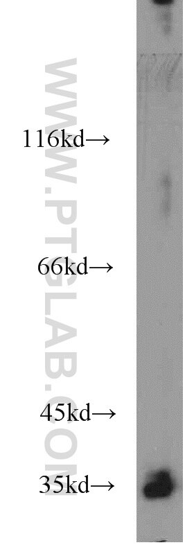 mouse kidney tissue were subjected to SDS PAGE followed by western blot with GAPDH Antibody 10494-1-AP GAPDH western blot WB 10494-1-AP GAPDH Antibody G3PD; GAPD; MGC88685