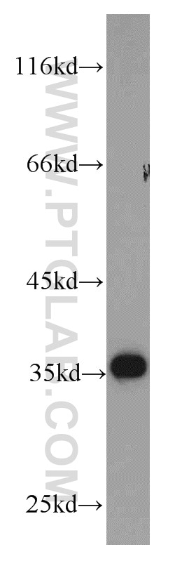 HEK-293 cells were subjected to SDS PAGE followed by western blot with GAPDH Antibody 10494-1-AP GAPDH western blot WB 10494-1-AP GAPDH Antibody G3PD; GAPD; MGC88685