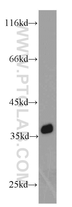 HeLa cells were subjected to SDS PAGE followed by western blot with GAPDH Antibody 10494-1-AP GAPDH western blot WB 10494-1-AP GAPDH Antibody G3PD; GAPD; MGC88685