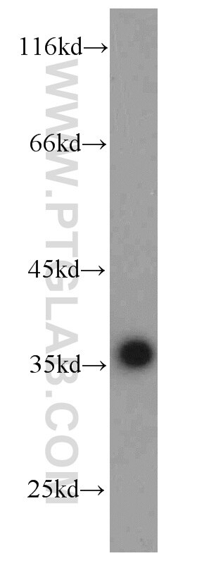 HepG2 cells were subjected to SDS PAGE followed by western blot with GAPDH Antibody 10494-1-AP GAPDH western blot WB 10494-1-AP GAPDH Antibody G3PD; GAPD; MGC88685