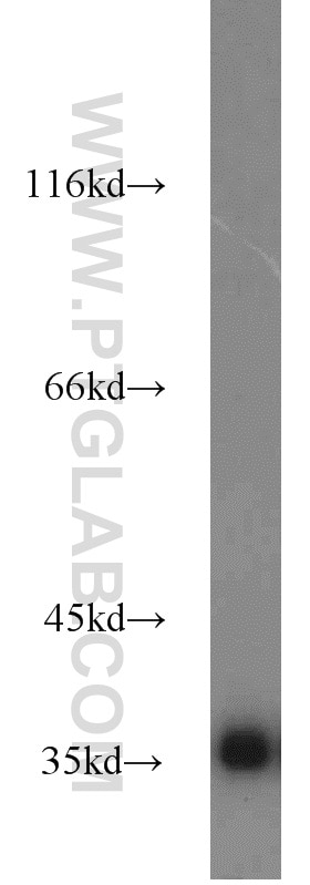 A549 cells were subjected to SDS PAGE followed by western blot with GAPDH Antibody 10494-1-AP GAPDH western blot WB 10494-1-AP GAPDH Antibody G3PD; GAPD; MGC88685