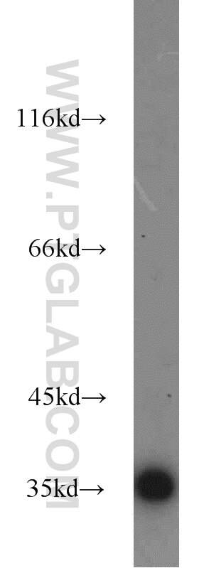 A549 cells were subjected to SDS PAGE followed by western blot with GAPDH Antibody 10494-1-AP GAPDH western blot WB 10494-1-AP GAPDH Antibody G3PD; GAPD; MGC88685
