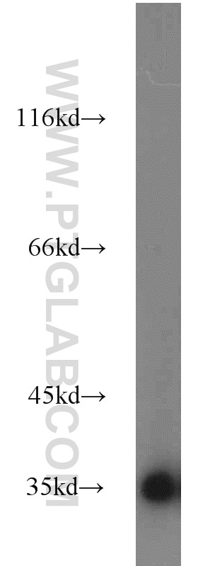 PC-13 cells were subjected to SDS PAGE followed by western blot with GAPDH Antibody 10494-1-AP GAPDH western blot WB 10494-1-AP GAPDH Antibody G3PD; GAPD; MGC88685