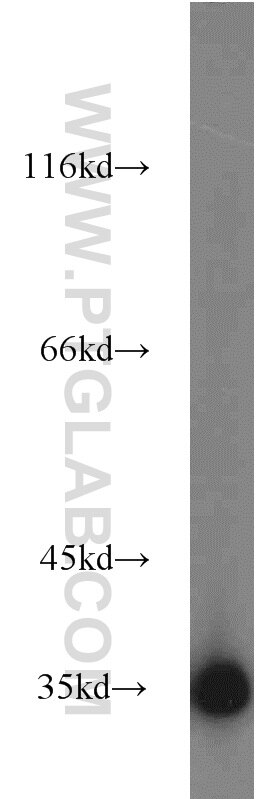 PC-13 cells were subjected to SDS PAGE followed by western blot with GAPDH Antibody 10494-1-AP GAPDH western blot WB 10494-1-AP GAPDH Antibody G3PD; GAPD; MGC88685