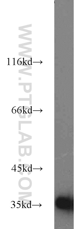 HEK-293 cells were subjected to SDS PAGE followed by western blot with GAPDH Antibody 10494-1-AP GAPDH western blot WB 10494-1-AP GAPDH Antibody G3PD; GAPD; MGC88685