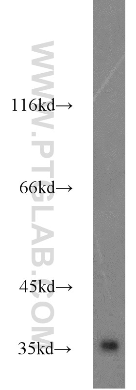 HEK-293 cells were subjected to SDS PAGE followed by western blot with GAPDH Antibody 10494-1-AP GAPDH western blot WB 10494-1-AP GAPDH Antibody G3PD; GAPD; MGC88685
