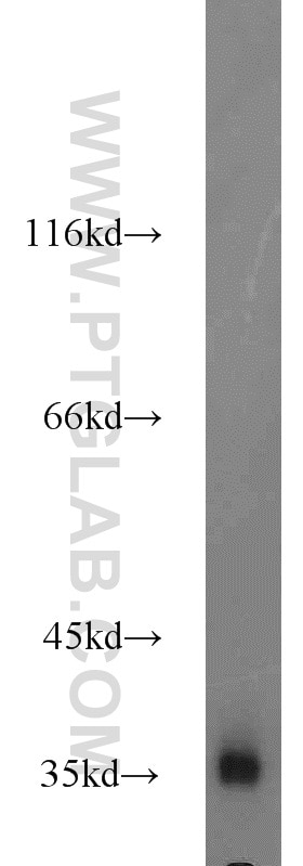 HeLa cells were subjected to SDS PAGE followed by western blot with GAPDH Antibody 10494-1-AP GAPDH western blot WB 10494-1-AP GAPDH Antibody G3PD; GAPD; MGC88685