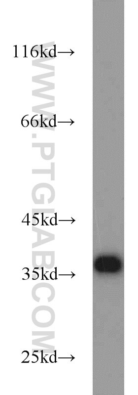 HEK-293 cells were subjected to SDS PAGE followed by western blot with GAPDH Antibody 10494-1-AP GAPDH western blot WB 10494-1-AP GAPDH Antibody G3PD; GAPD; MGC88685