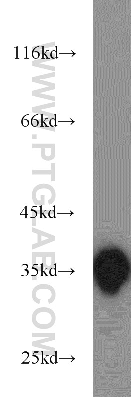 HeLa cells were subjected to SDS PAGE followed by western blot with GAPDH Antibody 10494-1-AP GAPDH western blot WB 10494-1-AP GAPDH Antibody G3PD; GAPD; MGC88685