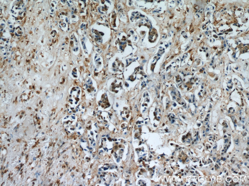 GAPDH IHC Immunohistochemical 60004-1-Ig GAPDH Antibody G3PD; GAPD; MGC88685