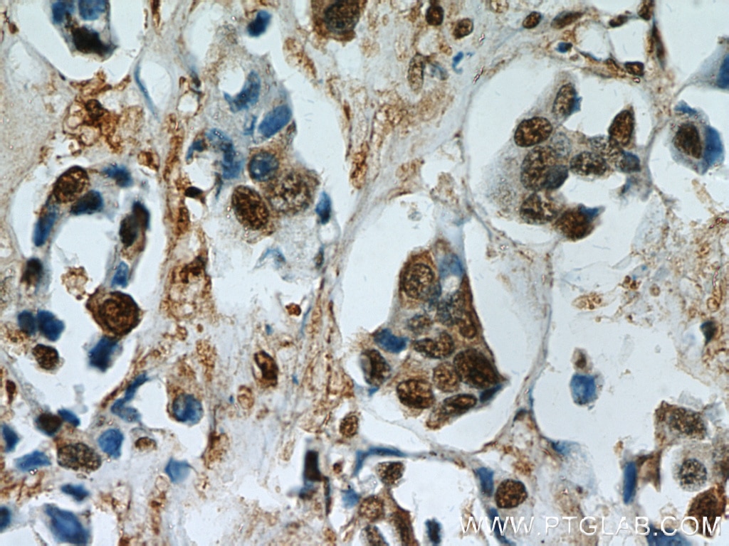 GAPDH IHC Immunohistochemical 60004-1-Ig GAPDH Antibody G3PD; GAPD; MGC88685