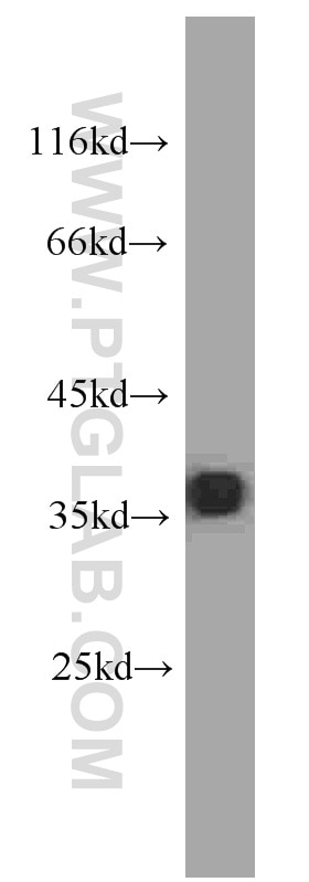 GAPDH western blot WB 60004-1-Ig GAPDH Antibody G3PD; GAPD; MGC88685