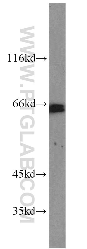 GATA6 western blot WB 55435-1-AP GATA6 Antibody 