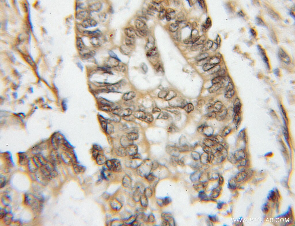 GBP2 IHC Immunohistochemical 11854-1-AP GBP2 Antibody 