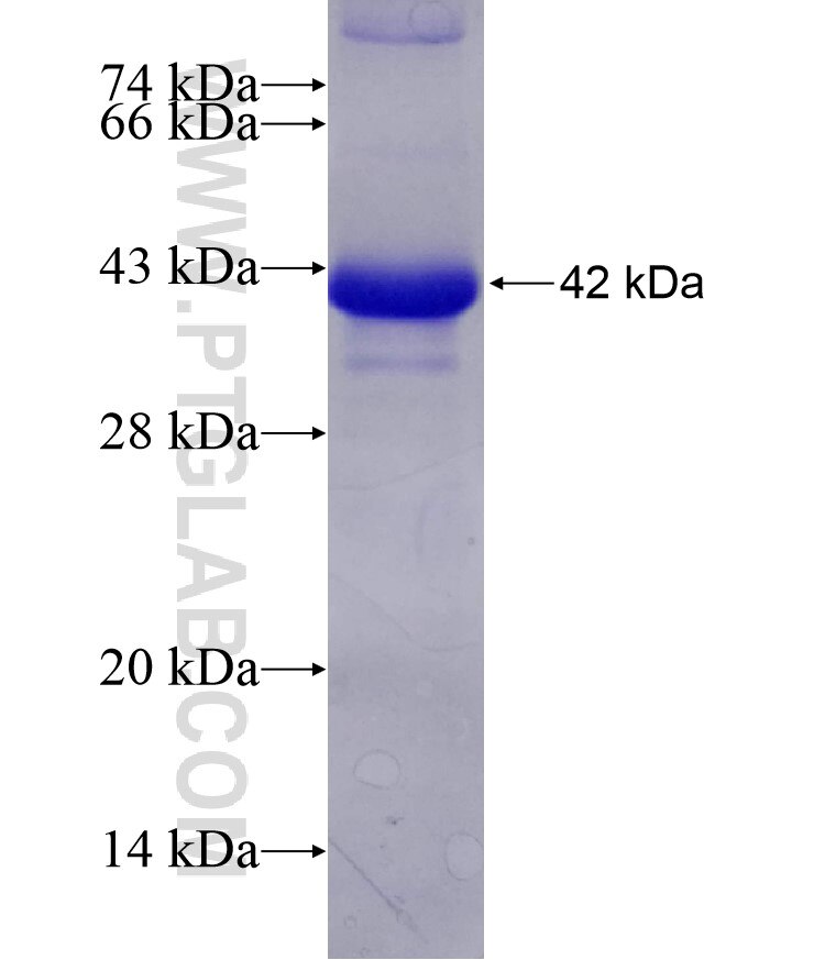 GCK fusion protein ag8116 SDS-PAGE