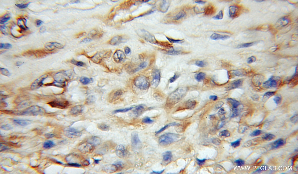 GDAP1L1 IHC Immunohistochemical 11977-1-AP GDAP1L1 Antibody DKFZp761K228; dJ881L22.1; dJ995J12.1.1