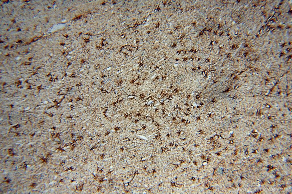 GFAP IHC Immunohistochemical 16825-1-AP GFAP Antibody FLJ45472