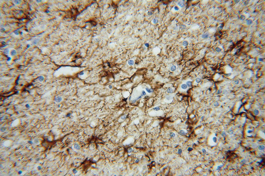 GFAP IHC Immunohistochemical 16825-1-AP GFAP Antibody FLJ45472