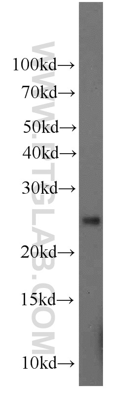A375 cells were subjected to SDS PAGE followed by western blot with 11293-1-AP(GFER Antibody) at dilution of 1:800 GFER western blot WB 11293-1-AP GFER Antibody ALR; ERV1; HERV1; HPO; HPO1; HPO2; HSS