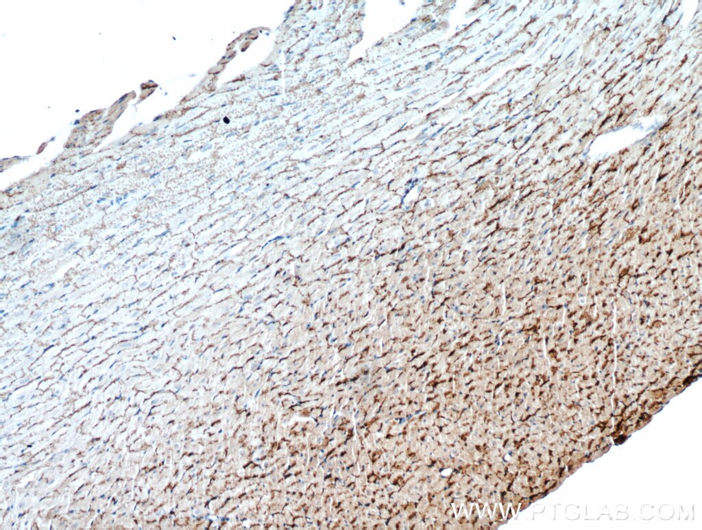 GJA1 IHC Immunohistochemical 15386-1-AP GJA1 Antibody CX43; DFNB38; GJAL; ODDD