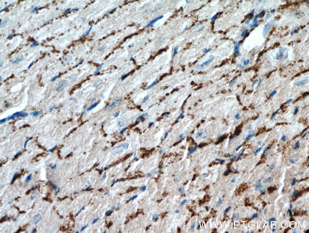 GJA1 IHC Immunohistochemical 15386-1-AP GJA1 Antibody CX43; DFNB38; GJAL; ODDD