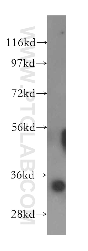 mouse brain tissue were subjected to SDS PAGE followed by western blot with 16788-1-AP(GLOD4 Antibody) at dilution of 1:1500 GLOD4 western blot WB 16788-1-AP GLOD4 Antibody C17orf25; CGI-150; HC71
