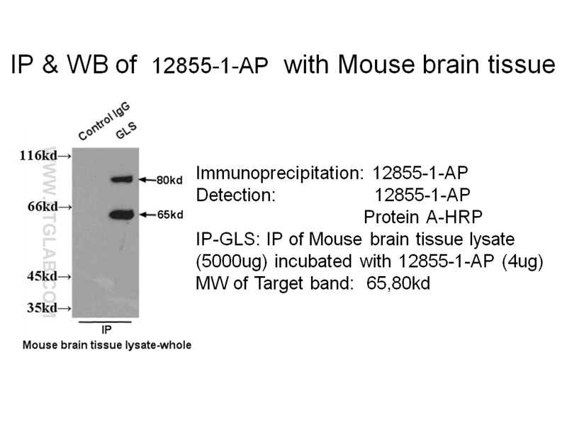 GLS IP 12855-1-AP GLS Antibody AAD20; DKFZp686O15119; FLJ10358; GLS1; KIAA0838