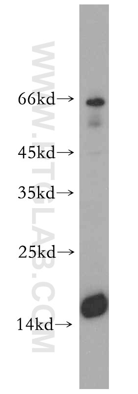 mouse brain tissue were subjected to SDS PAGE followed by western blot with 10690-1-AP(GMFB Antibody) at dilution of 1:2000 GMFB western blot WB 10690-1-AP GMFB Antibody GMF